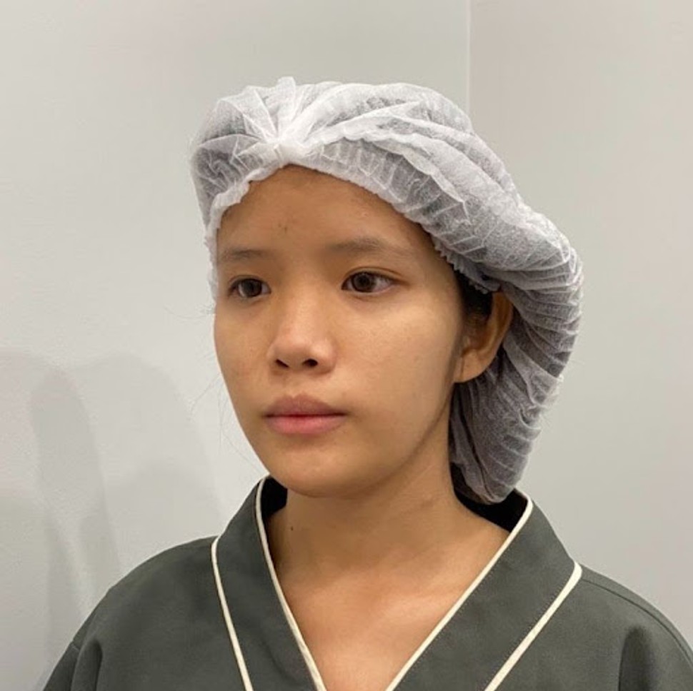 รวมรีวิวเสริมจมูกเนื้อน้อย คัดมาแบบปัง ๆ 10 เคส | EMMA Clinic 5 unnamedz z364979045404