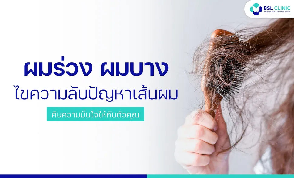 ผมร่วง ผมบาง ศีรษะล้าน - ศูนย์รักษาปัญหาผิวหนัง