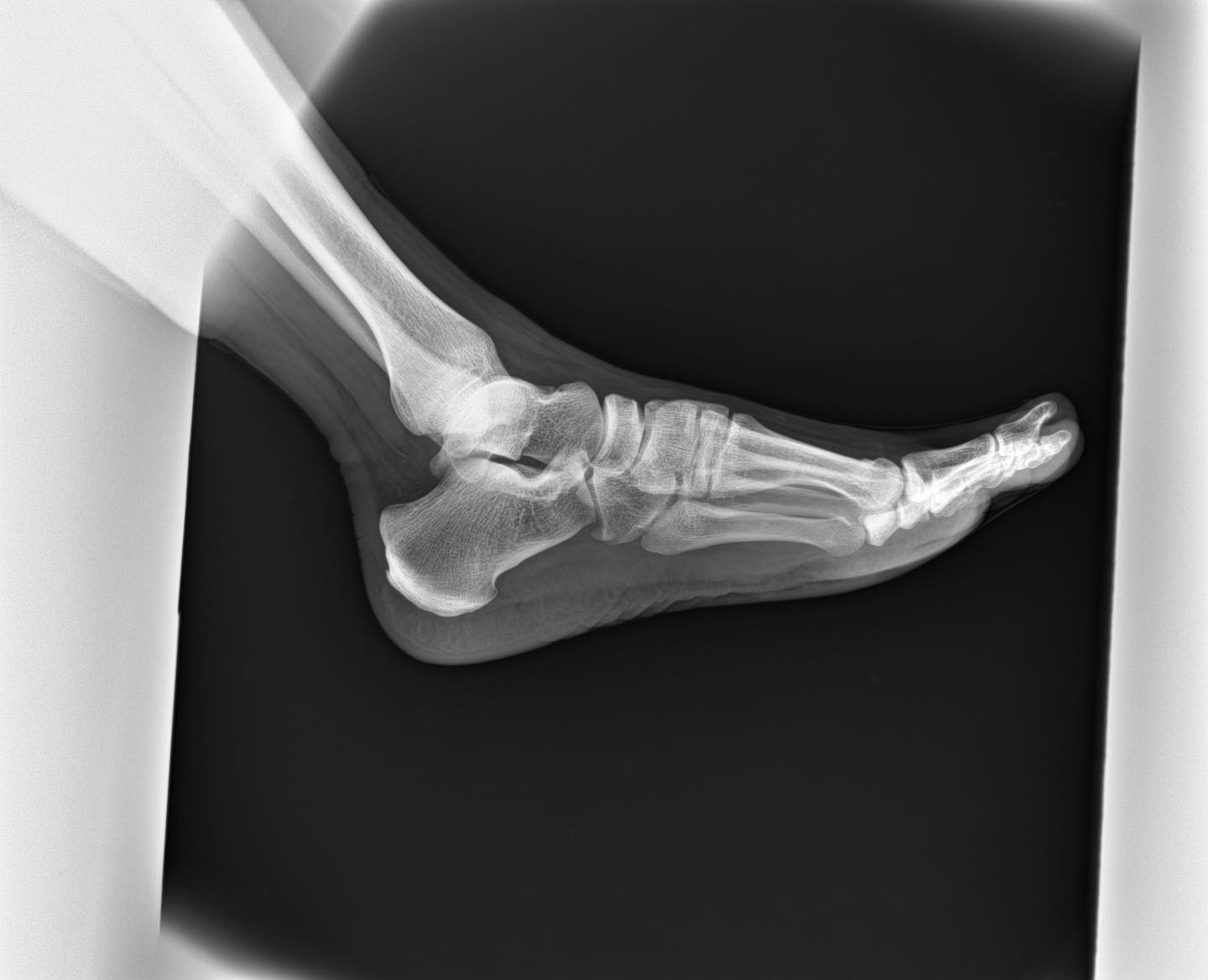 บริการ ขายเครื่องมือแพทย์มือสอง และของใหม่ ประกัน1ปี มีเครื่องสำรอง