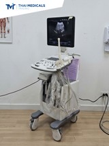 SonoAce X7 (2)