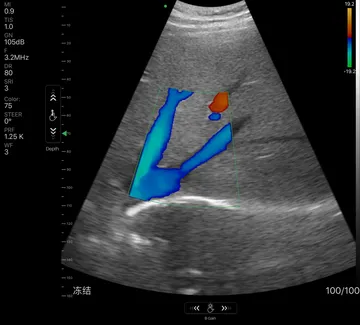 D2CL-liver-C