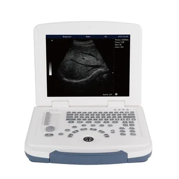 dw-580-ultrasound