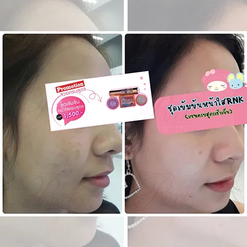 iTopPlus50601282218