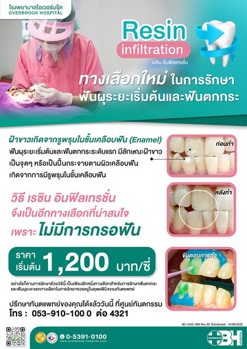 เรซินอินฟิลเทรชั่นcopy