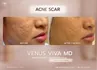 venusviva-web-05