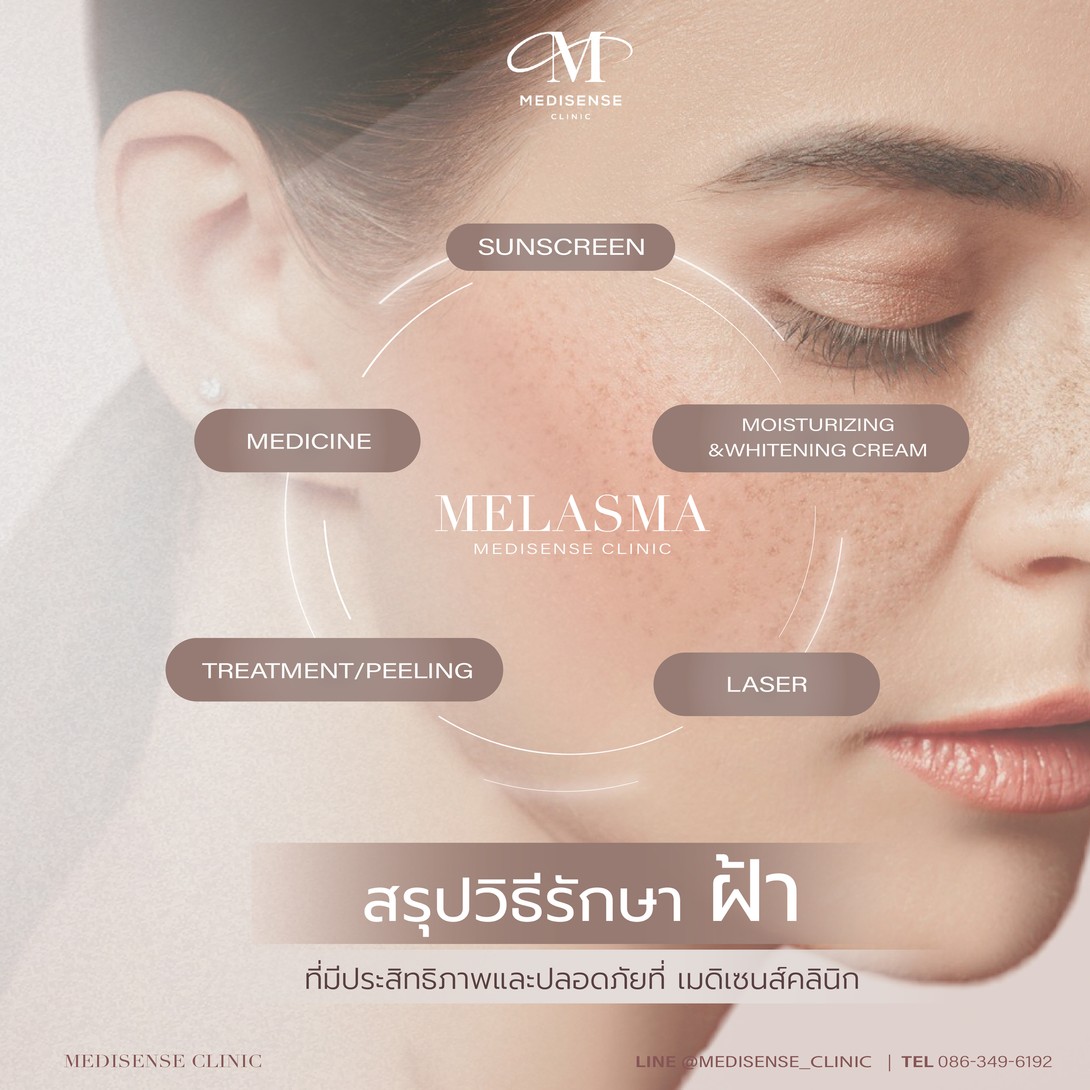 (CoverIG)AdsAlbum-07-05-01