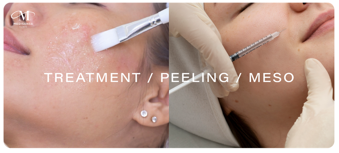 webMELASMA02-06
