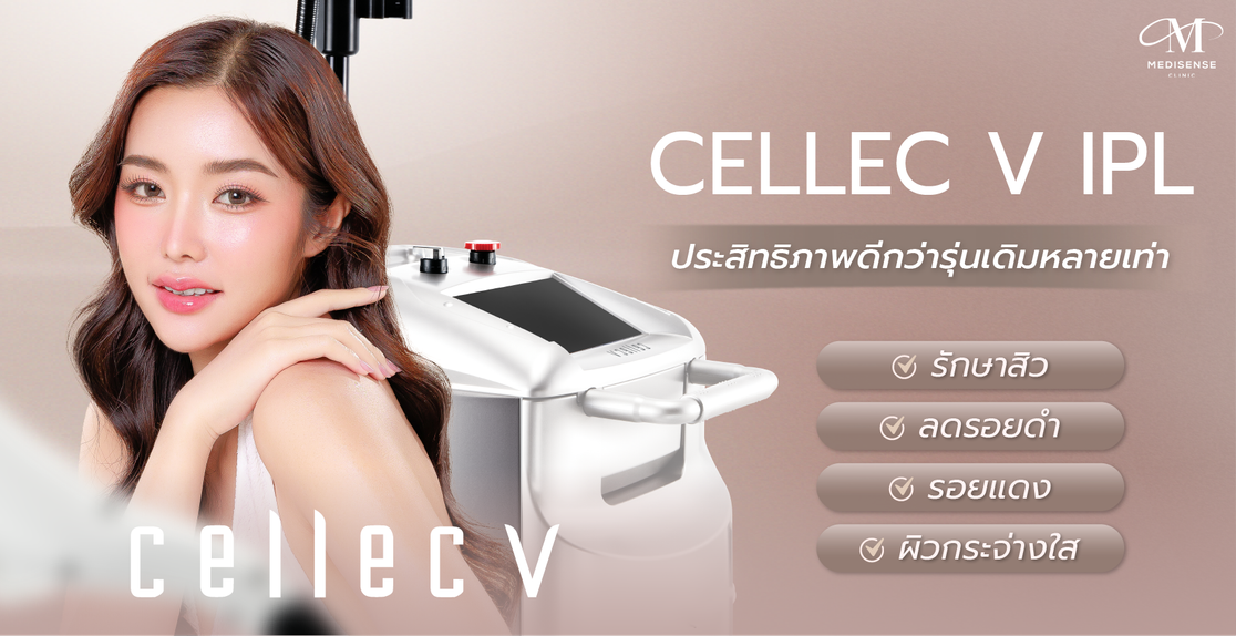 CellecV-Pic-02
