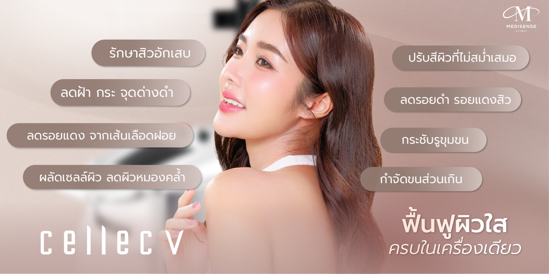 CellecV-Pic-05