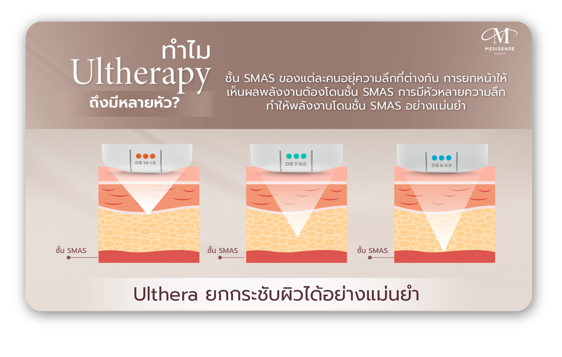 ulthera-Pic-04