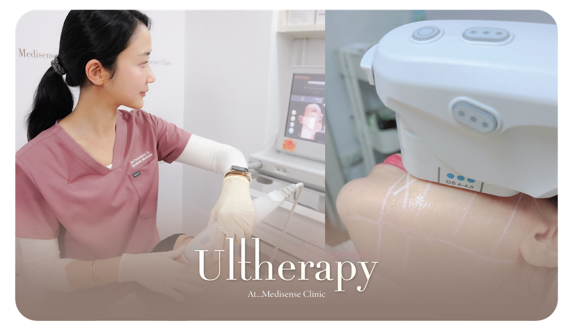 ulthera-Pic-07