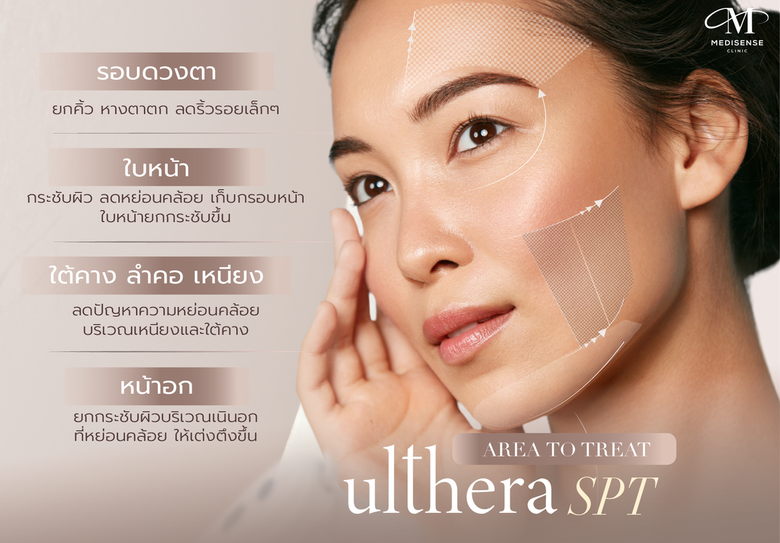ulthera-Pic-09
