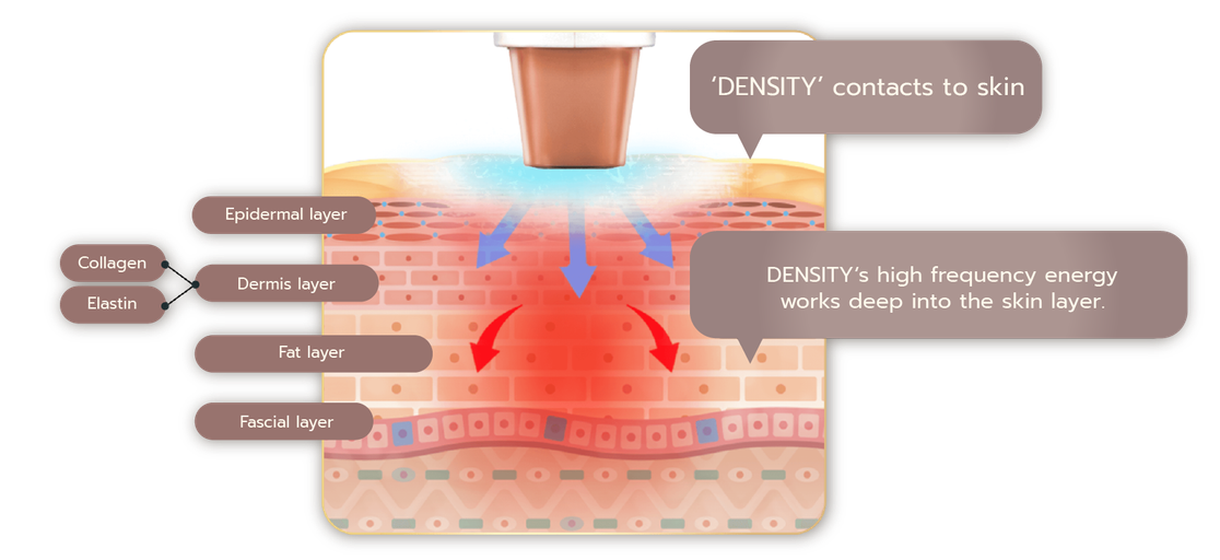 webdensity-02
