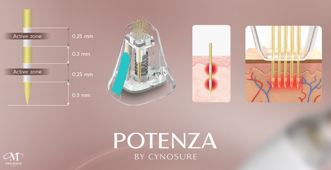 Potenza-pic-02