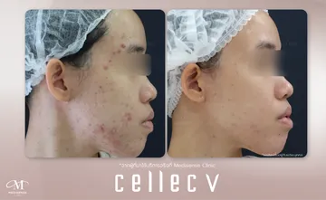 CellecV-Pic-06
