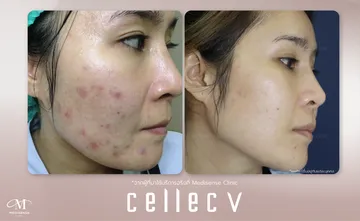 CellecV-Pic-07
