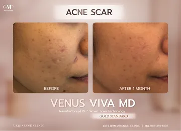 venusviva-web-04