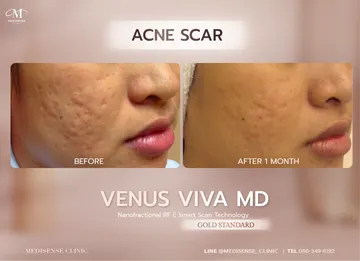 venusviva-web-05