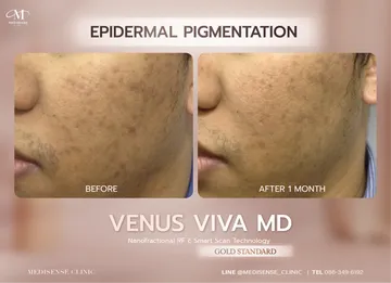venusviva-web-06
