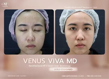 venusviva-web-07