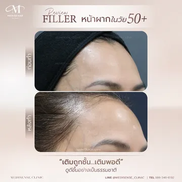 web-Filler-final-15