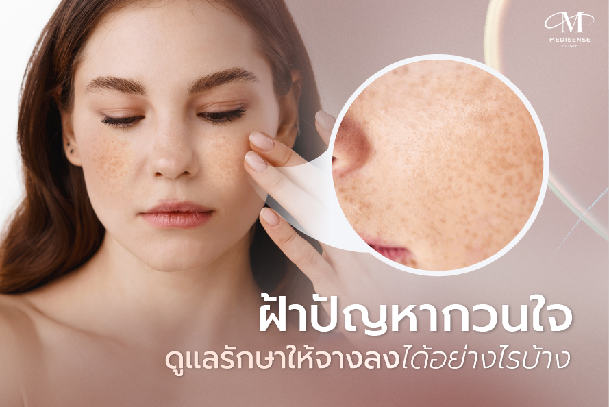 webMELASMA01-02