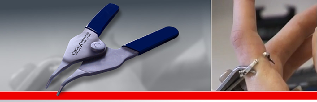 featurepicringremoval