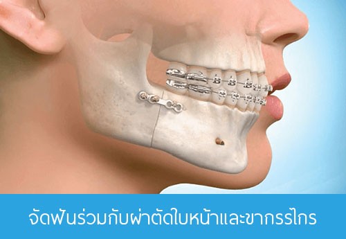 iTopPlus1370783438420