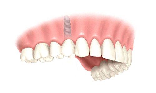 iTopPlus1439739586100