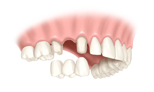 iTopPlus399000053429