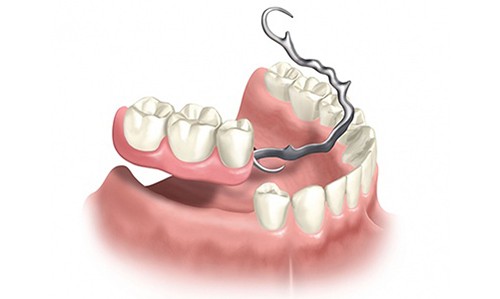 iTopPlus426098332496