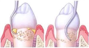iTopPlus780143575134