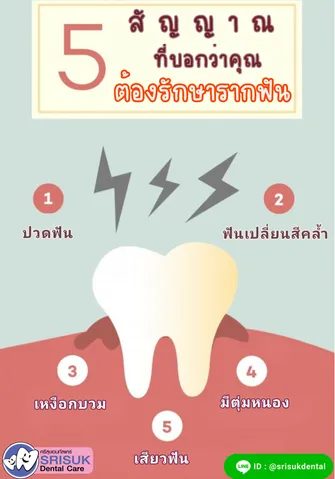 เช็คด่วน! 5 สัญญาณ ที่บอกว่าคุณ จะต้องรักษารากฟัน