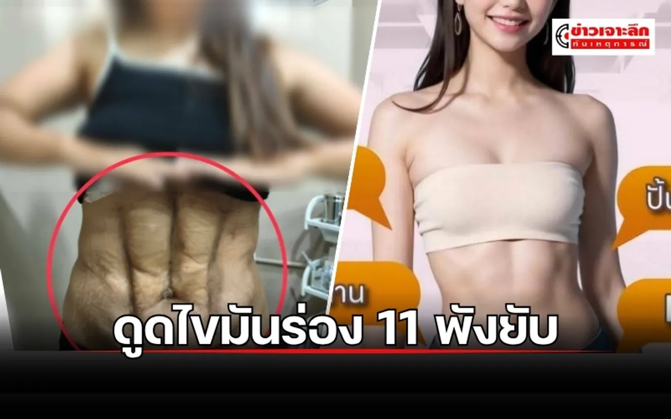 ข่าว