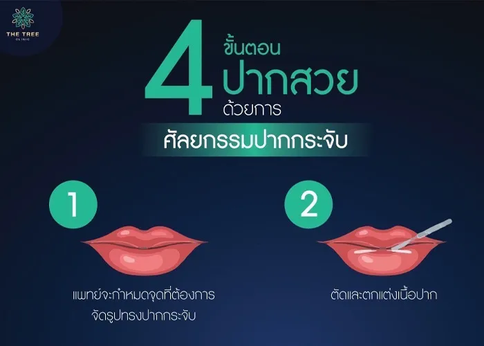 article-4