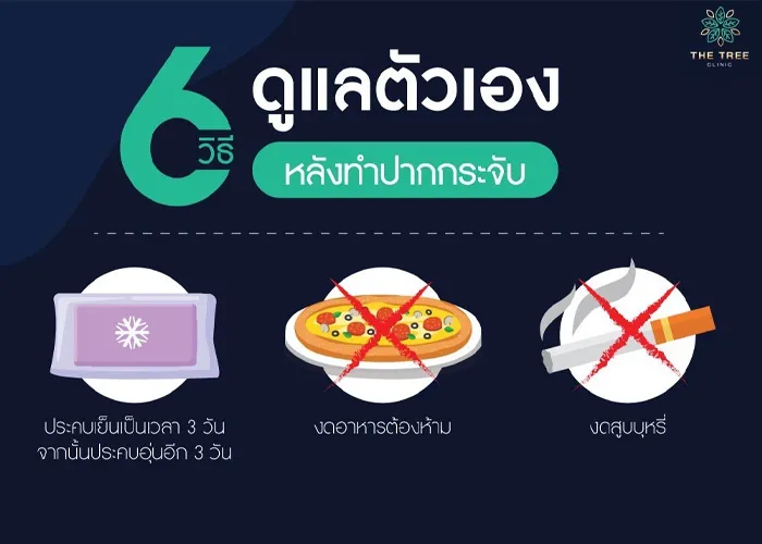 article-5
