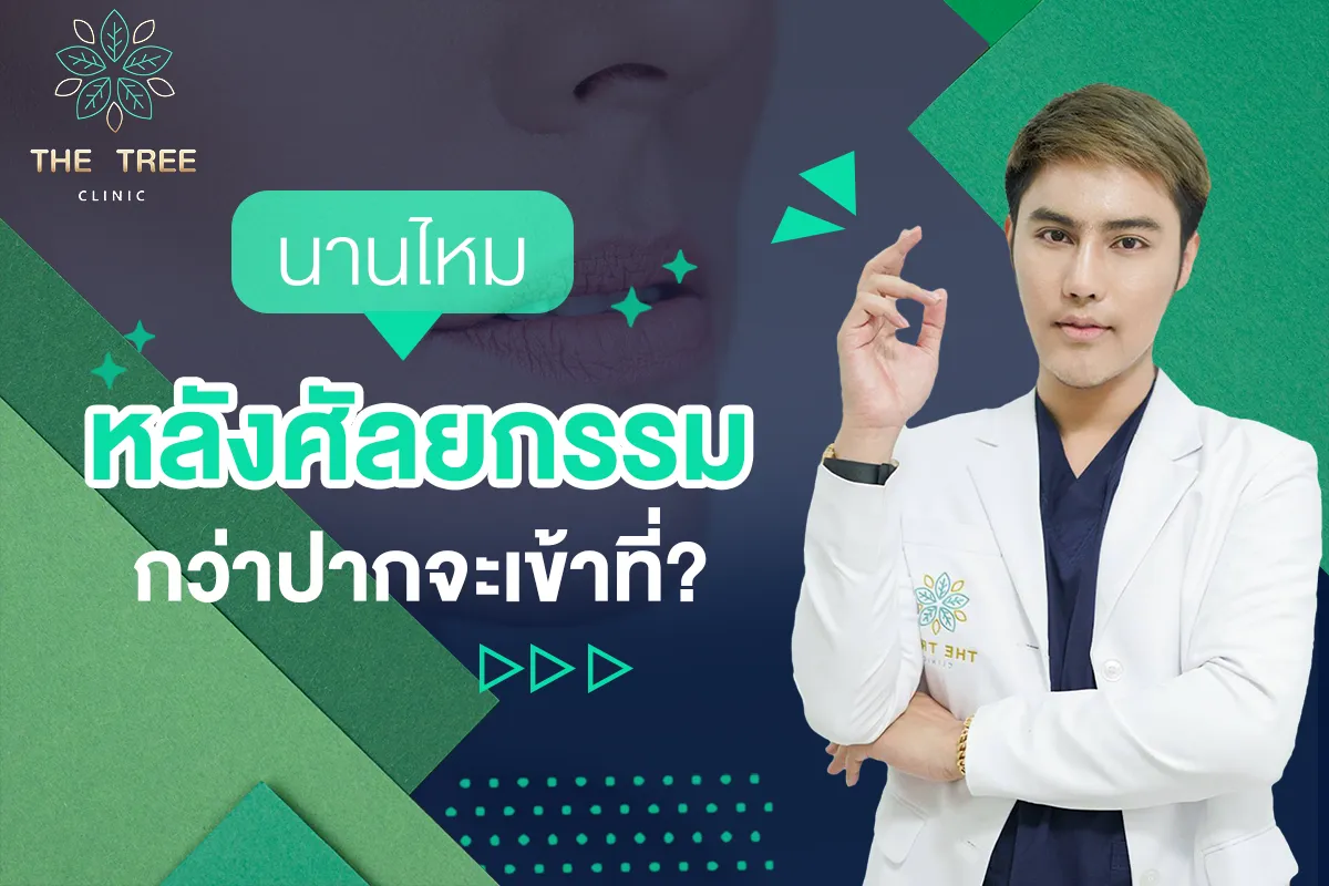 นานไหมหลังศัลยกรรม