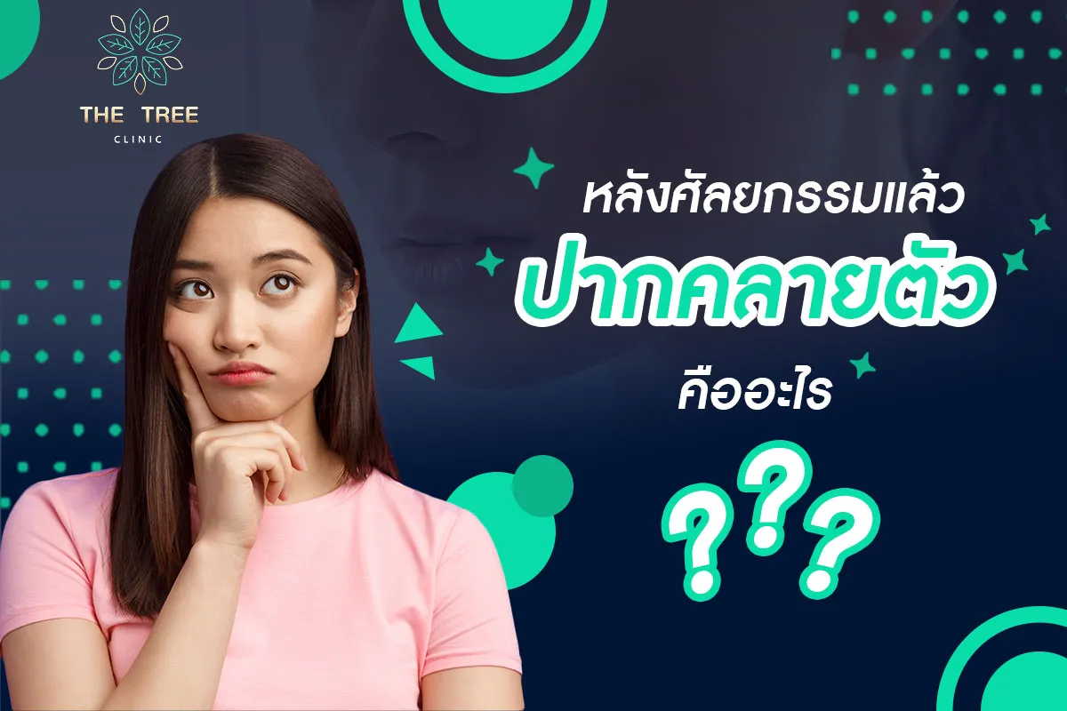 ปากคลายตัว