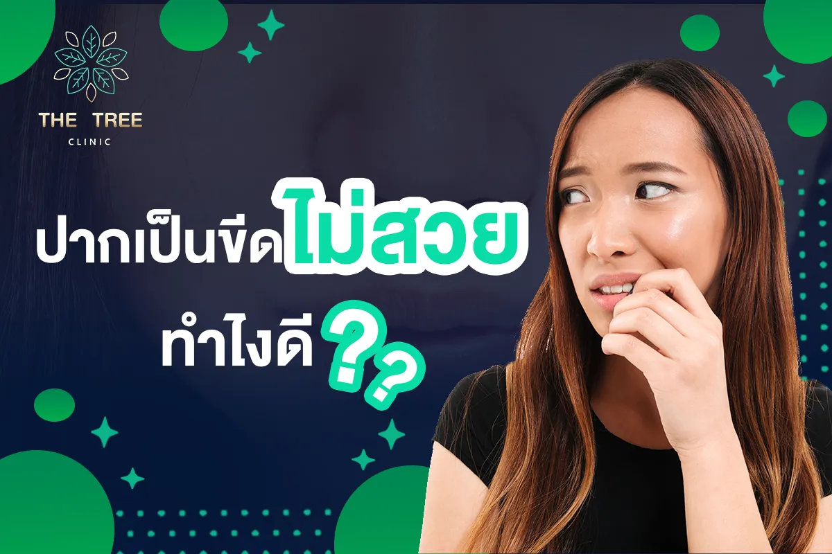 ปากมีขีด