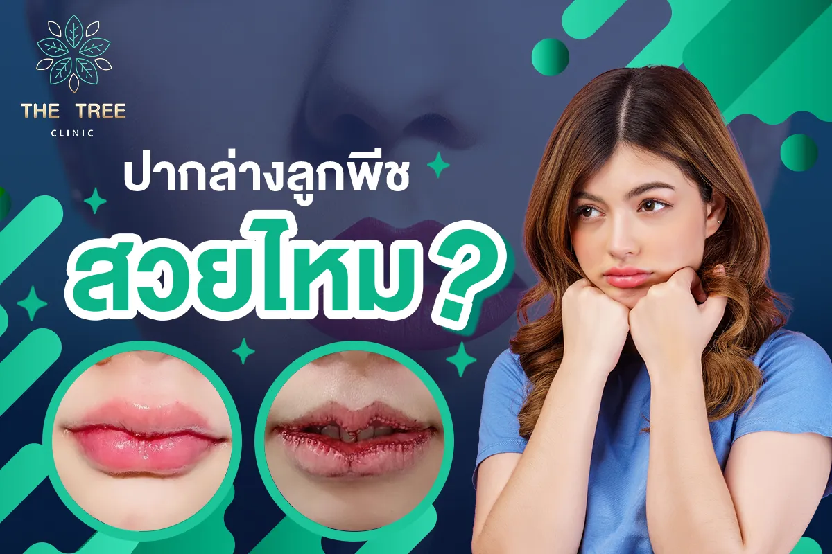 ปากล่างลูกพีช