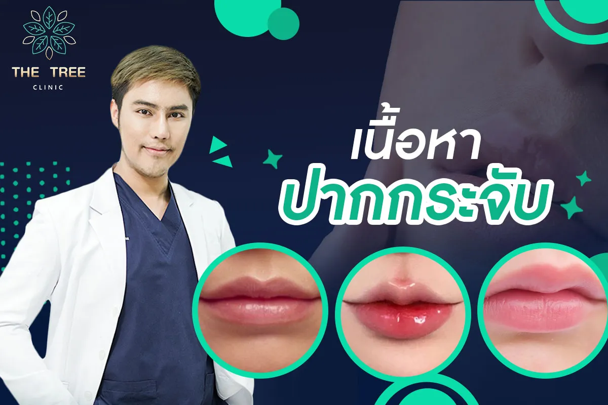 เนื้อหาปากกระจับ
