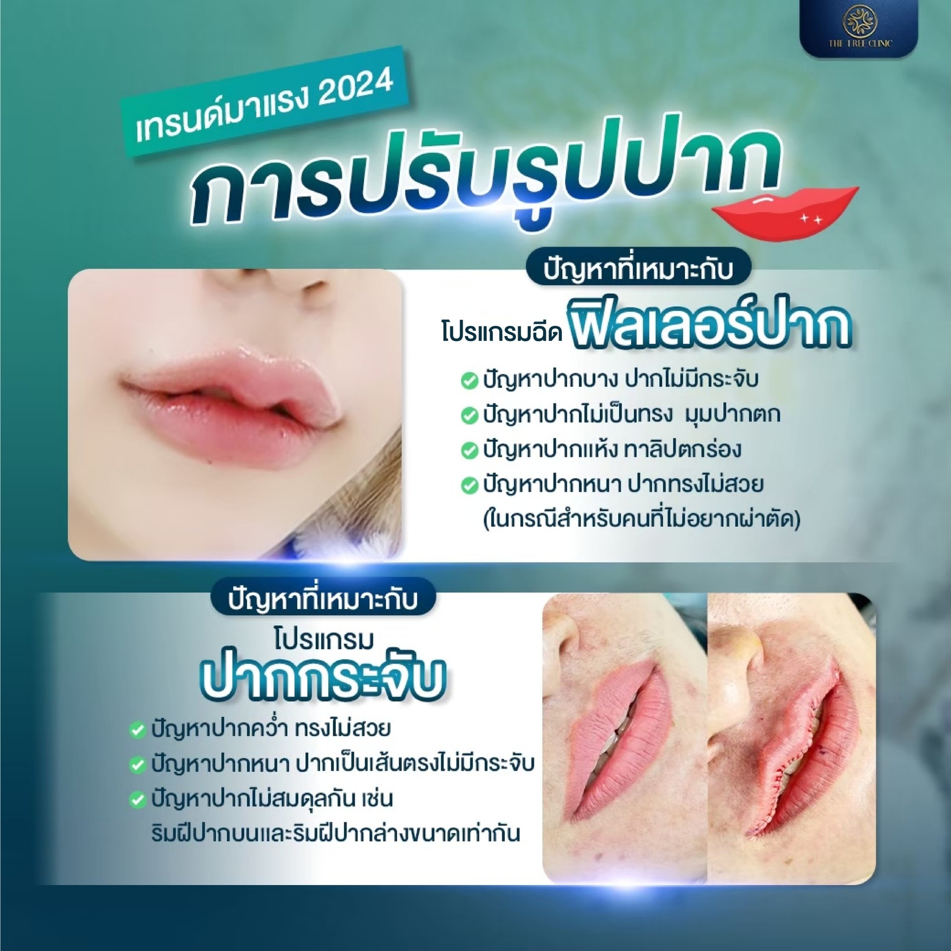 LINEALBUM%E0%B8%A0%E0%B8%B2%E0%B8%9Ethetree%E0%B9%80%E0%B8%A7%E0%B9%87%E0%B8%9A%E0%B9%84%E0%B8%8B%E0%B8%95%E0%B9%8C%E0%B9%81%E0%B8%81%E0%B9%89%E0%B9%84%E0%B8%82%E0%B9%81%E0%B8%A5%E0%B9%89%E0%B8%A7%E0%B8%84%E0%B8%A3%E0%B8%B1%E0%B8%9A2409038