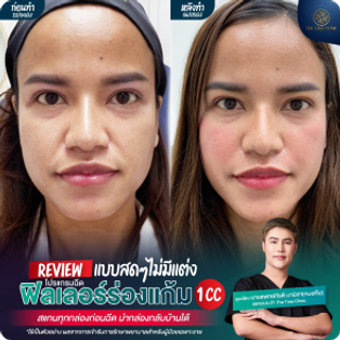image21(1)