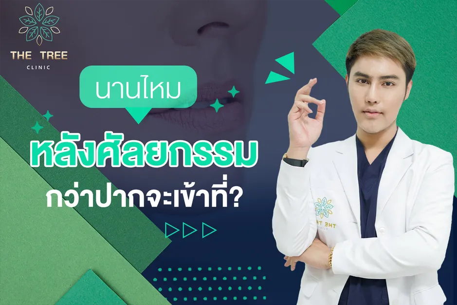 นานไหมหลังศัลยกรรม