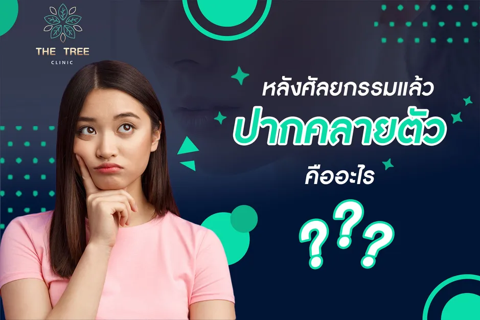 ปากคลายตัว