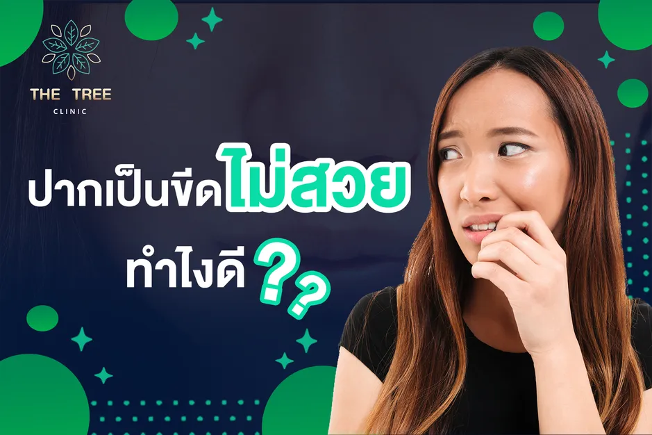 ปากมีขีด