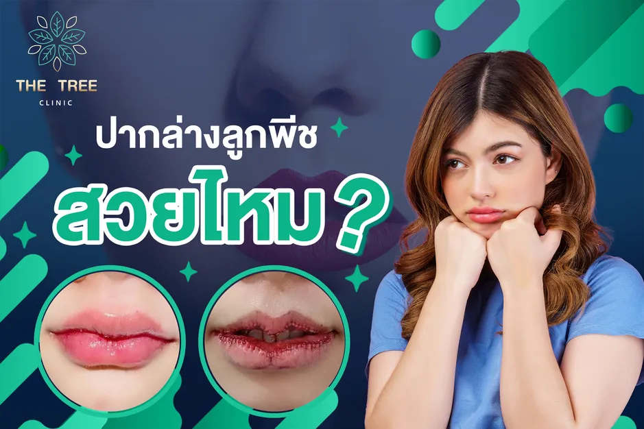 ปากล่างลูกพีช