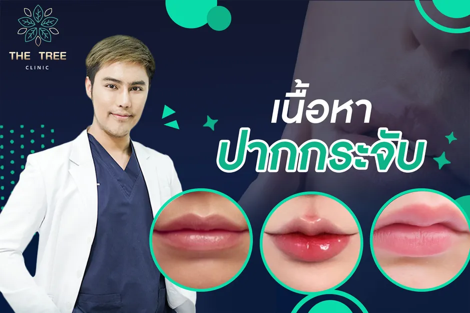 เนื้อหาปากกระจับ