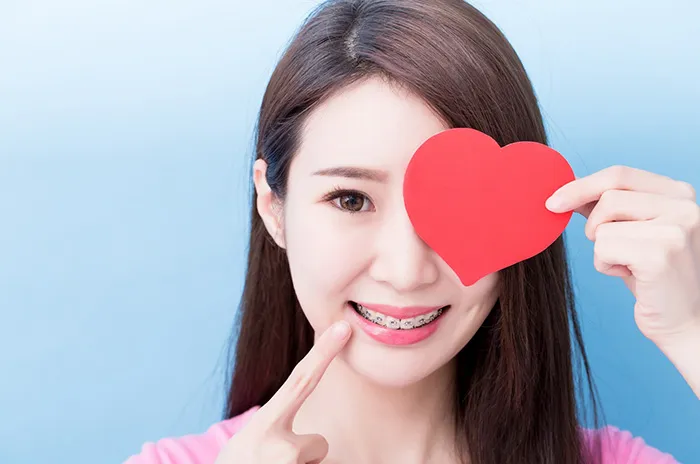 จัดฟัน