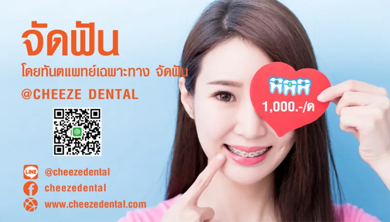 โปรจัดฟัน-63-1